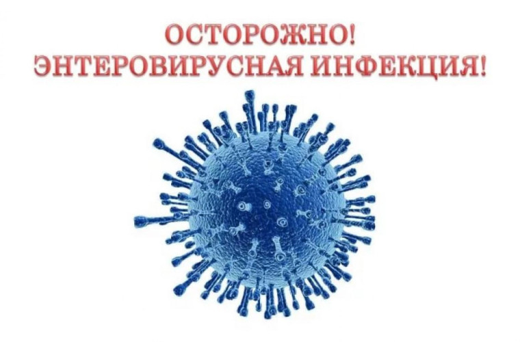 ОСТОРОЖНО!ЭНТЕРОВИРУСНАЯ ИНФЕКЦИЯ.